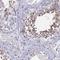 Coiled-Coil Domain Containing 36 antibody, HPA045690, Atlas Antibodies, Immunohistochemistry paraffin image 