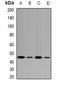 Fumarylacetoacetate Hydrolase antibody, orb341119, Biorbyt, Western Blot image 