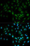 Mitogen-activated protein kinase 7 antibody, 18-510, ProSci, Immunofluorescence image 