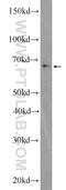 Zinc Finger And BTB Domain Containing 46 antibody, 25455-1-AP, Proteintech Group, Western Blot image 