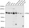 Karyopherin Subunit Beta 1 antibody, A01851, Boster Biological Technology, Western Blot image 
