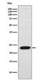 Troponin I2, Fast Skeletal Type antibody, M07355-1, Boster Biological Technology, Western Blot image 