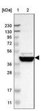 GRAM Domain Containing 1B antibody, NBP1-81431, Novus Biologicals, Western Blot image 