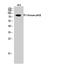 Phosphoinositide-3-Kinase Regulatory Subunit 2 antibody, STJ95080, St John