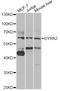 Dual Specificity Tyrosine Phosphorylation Regulated Kinase 2 antibody, STJ29092, St John