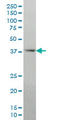 Distal-Less Homeobox 2 antibody, LS-B5397, Lifespan Biosciences, Western Blot image 