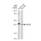 Suppressor Of Cytokine Signaling 2 antibody, GTX03238, GeneTex, Western Blot image 