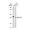 Suppressor of cytokine signaling 2 antibody, GTX03238, GeneTex, Western Blot image 