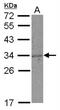 Killer Cell Lectin Like Receptor C1 antibody, NBP2-17084, Novus Biologicals, Western Blot image 