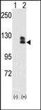 EPH Receptor B2 antibody, AP14298PU-N, Origene, Western Blot image 
