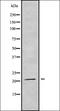 Trafficking Protein Particle Complex 5 antibody, orb338761, Biorbyt, Western Blot image 