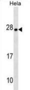 Zinc Finger Matrin-Type 4 antibody, abx030186, Abbexa, Western Blot image 