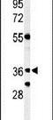 NSE4 Homolog A, SMC5-SMC6 Complex Component antibody, PA5-26905, Invitrogen Antibodies, Western Blot image 