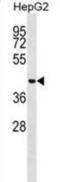 Microspherule Protein 1 antibody, abx029123, Abbexa, Western Blot image 