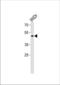 Transcription Factor Dp Family Member 3 antibody, TA324652, Origene, Western Blot image 