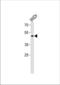 Transcription Factor Dp Family Member 3 antibody, TA324652, Origene, Western Blot image 