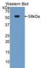 Tissue Factor Pathway Inhibitor antibody, LS-C372522, Lifespan Biosciences, Western Blot image 