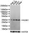 Killer Cell Lectin Like Receptor K1 antibody, CSB-PA012474LA01HU, Cusabio, Western Blot image 
