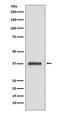 Cyclin Dependent Kinase 6 antibody, M00358, Boster Biological Technology, Western Blot image 