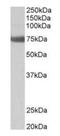 Transglutaminase 6 antibody, orb125216, Biorbyt, Western Blot image 