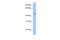 Zinc Finger Protein 485 antibody, A16950, Boster Biological Technology, Western Blot image 