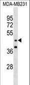 GRAM Domain Containing 2B antibody, LS-C159783, Lifespan Biosciences, Western Blot image 