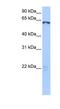 Lin-9 DREAM MuvB Core Complex Component antibody, NBP1-79424, Novus Biologicals, Western Blot image 