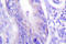 WASP Family Member 1 antibody, LS-C176482, Lifespan Biosciences, Immunohistochemistry frozen image 