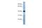 Transmembrane Protein 115 antibody, PA5-42929, Invitrogen Antibodies, Western Blot image 