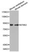 Neurotrophic Receptor Tyrosine Kinase 2 antibody, abx000731, Abbexa, Western Blot image 