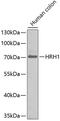 Histamine Receptor H1 antibody, 15-434, ProSci, Western Blot image 