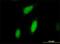 Ribosomal Protein S6 Kinase A3 antibody, H00006197-M01, Novus Biologicals, Immunofluorescence image 