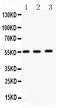 Matrix Metallopeptidase 14 antibody, LS-C357469, Lifespan Biosciences, Western Blot image 