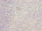 Integrin Subunit Alpha L antibody, CSB-PA011875LA01HU, Cusabio, Immunohistochemistry frozen image 
