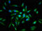 Protein Kinase C Beta antibody, LS-C671010, Lifespan Biosciences, Immunofluorescence image 