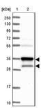 Heme Oxygenase 2 antibody, NBP1-91981, Novus Biologicals, Western Blot image 