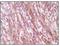 Desmin antibody, NB110-60508, Novus Biologicals, Immunohistochemistry paraffin image 