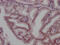 Androgen Receptor antibody, CSB-RA243116A0HU, Cusabio, Immunohistochemistry paraffin image 
