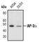 Transcription Factor AP-2 Alpha antibody, PA5-17359, Invitrogen Antibodies, Western Blot image 