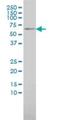 TGF-Beta Activated Kinase 1 (MAP3K7) Binding Protein 1 antibody, H00010454-M01, Novus Biologicals, Western Blot image 