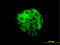 Junction Plakoglobin antibody, LS-B4364, Lifespan Biosciences, Immunofluorescence image 