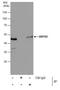 SET And MYND Domain Containing 2 antibody, PA5-30732, Invitrogen Antibodies, Immunoprecipitation image 