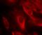 Mitogen-Activated Protein Kinase Kinase 6 antibody, GTX50204, GeneTex, Immunocytochemistry image 