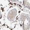 Synaptotagmin-like protein 5 antibody, NBP1-90926, Novus Biologicals, Immunohistochemistry paraffin image 