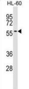 Interferon Related Developmental Regulator 2 antibody, abx029401, Abbexa, Western Blot image 