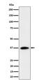 Ras association domain-containing protein 2 antibody, M04384-1, Boster Biological Technology, Western Blot image 