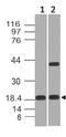 Chymotrypsin Like Elastase 3B antibody, A09940, Boster Biological Technology, Western Blot image 