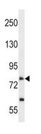 Solute Carrier Family 28 Member 2 antibody, abx028647, Abbexa, Western Blot image 