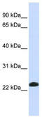 Caveolin 2 antibody, TA330402, Origene, Western Blot image 