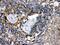 Transglutaminase 2 antibody, PB9448, Boster Biological Technology, Immunohistochemistry paraffin image 